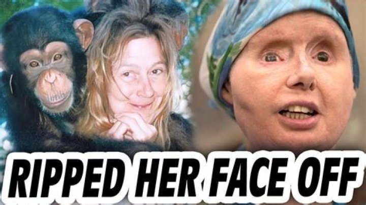 Oprah Winfrey Interviews Chimp Attack Victim; Woman Unveils Disfigured Face